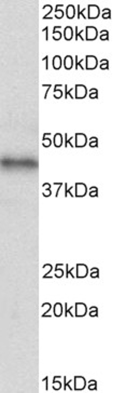 43-695 (0.3ug/ml) staining of NIH3T3 (A) , HeLa (B) , K562 (C) , MCF7 (D) and HepG2 (E) lysates (35ug protein in RIPA buffer) . Primary incubation was 1 hour. Detected by chemiluminescence.