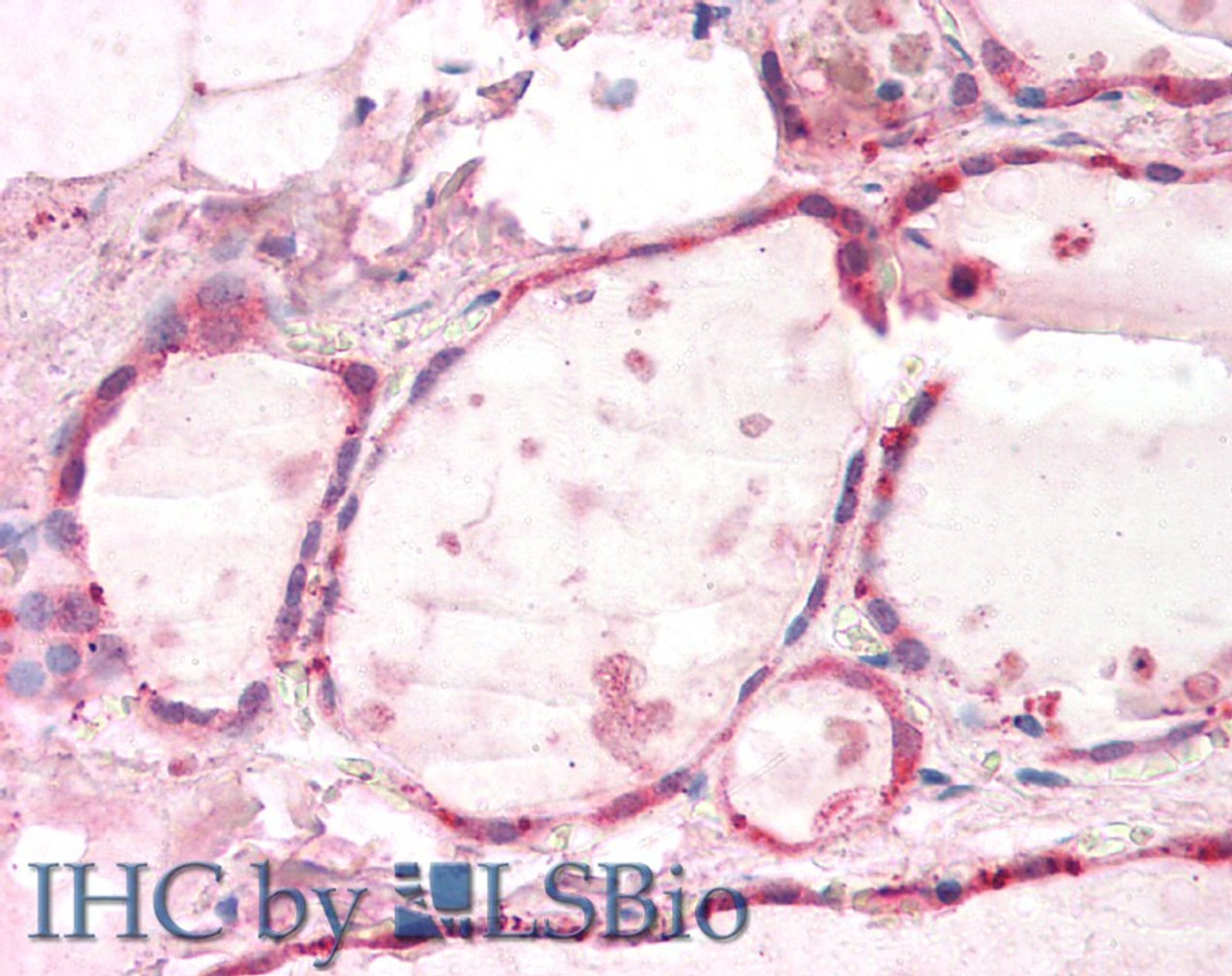 43-696 (1ug/ml) staining of Human Kidney lysate (35ug protein in RIPA buffer) . Primary incubation was 1 hour. Detected by chemiluminescence.