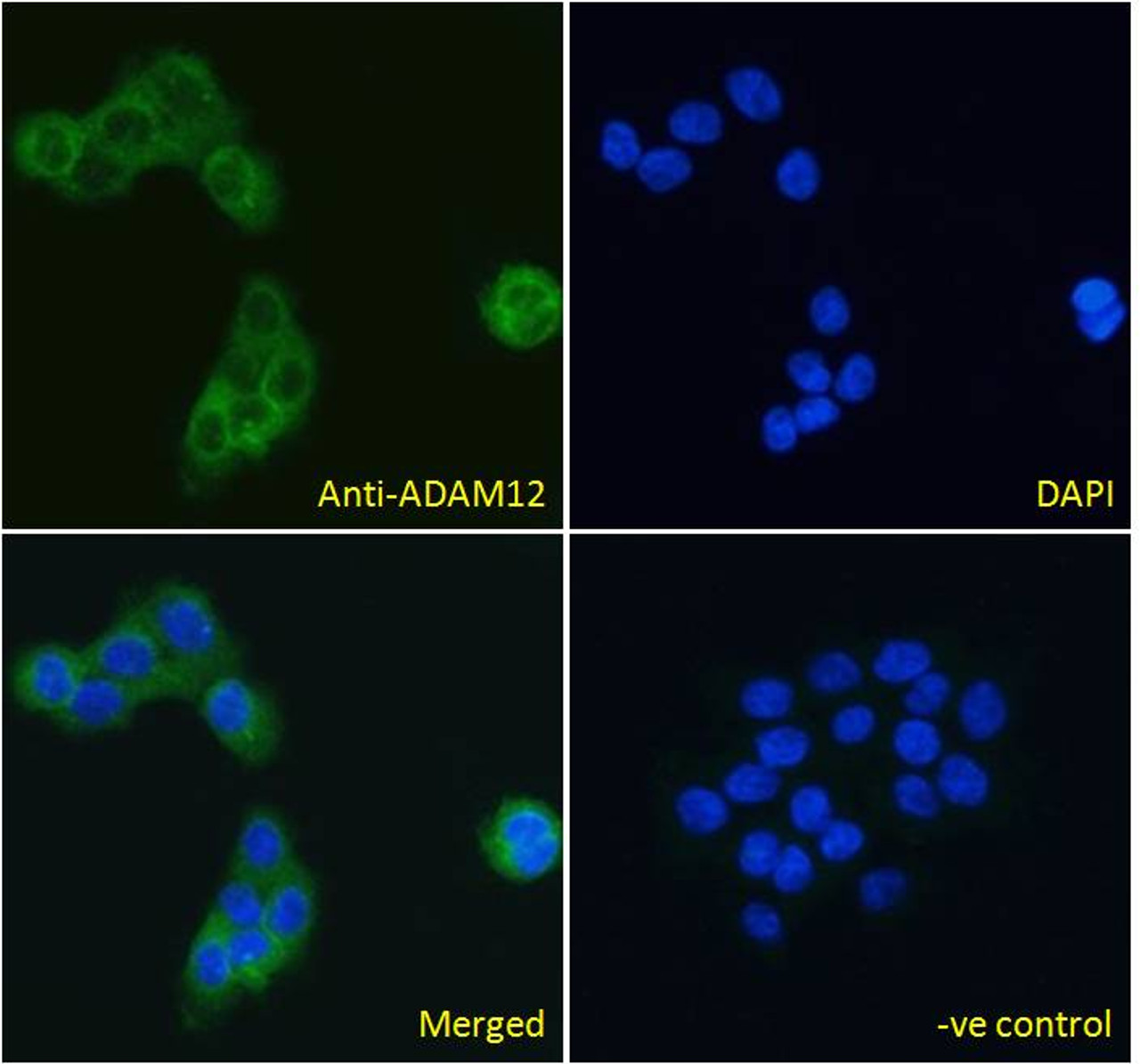 45-001 Immunofluorescence analysis of paraformaldehyde fixed A431 cells, permeabilized with 0.15% Triton. Primary incubation 1hr (10ug/ml) followed by Alexa Fluor 488 secondary antibody (4ug/ml) , showing cytoplasmic/plasma membrane staining. The nuclear