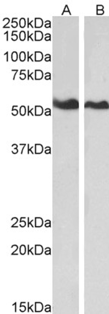 45-007 (0.01ug/ml) staining of HeLa (A) and Jurkat (B) lysates (35ug protein in RIPA buffer) . Primary incubation was 1 hour. Detected by chemiluminescence.