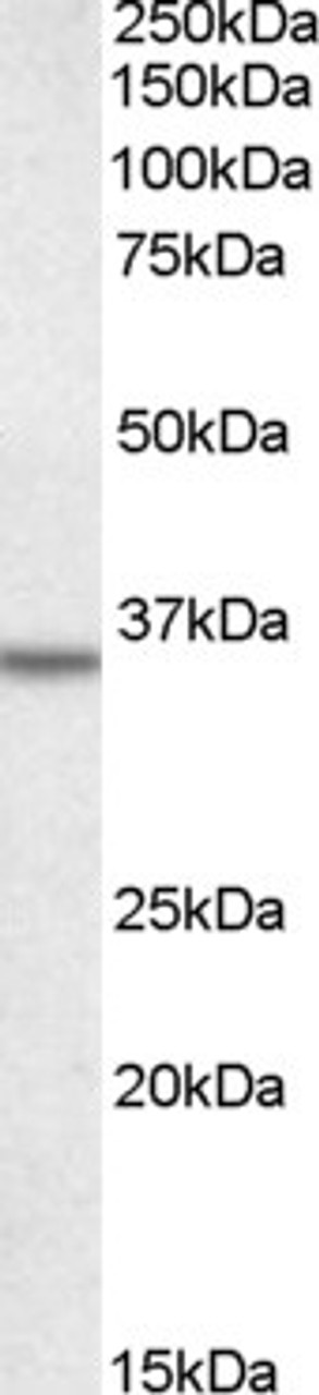 45-008 staining (0.5ug/ml) of A431 lysate (RIPA buffer, 35ug total protein per lane) . Primary incubated for 1 hour. Detected by western blot using chemiluminescence.