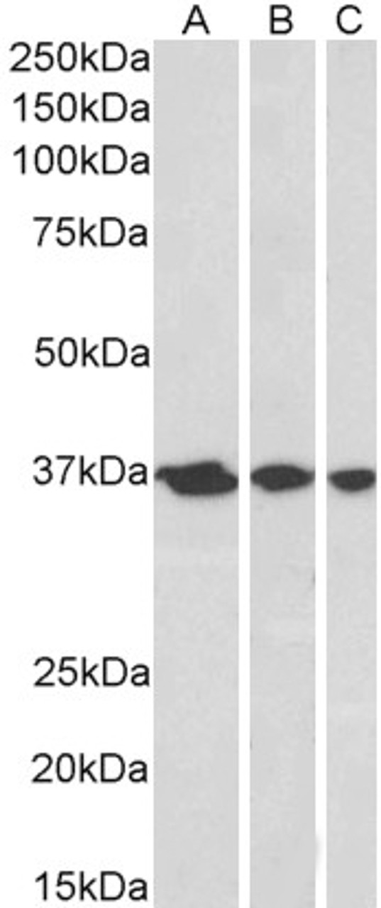 45-009 (0.3ug/ml) staining of A431 (A) , HeLa (B) and MCF7 (C) nuclear lysates (35ug protein in RIPA buffer) . Primary incubation was 1 hour. Detected by chemiluminescence.