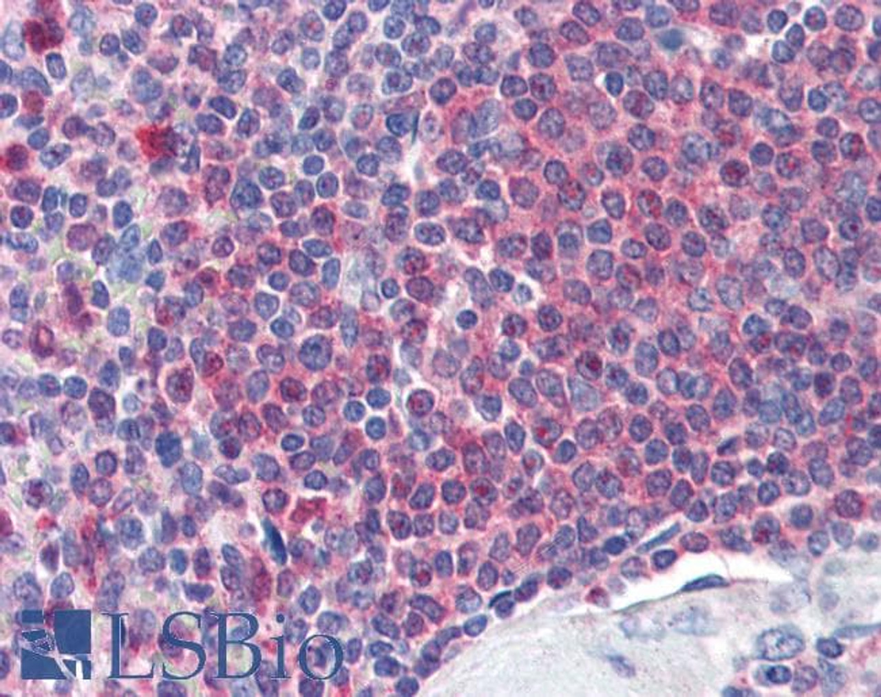 45-026 (2ug/ml) staining of paraffin embedded Human Liver. Steamed antigen retrieval with citrate buffer pH 6, AP-staining. <strong>This data is from a previous batch, not on sale.</strong>