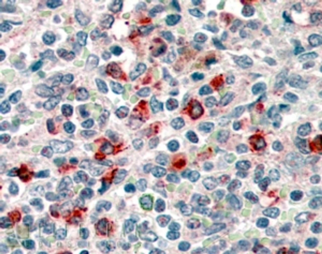 45-030 (1ug/ml) staining of PBM lysate (35ug protein in RIPA buffer) with (B) and without (A) blocking with the immunizing peptide. Detected by chemiluminescence.