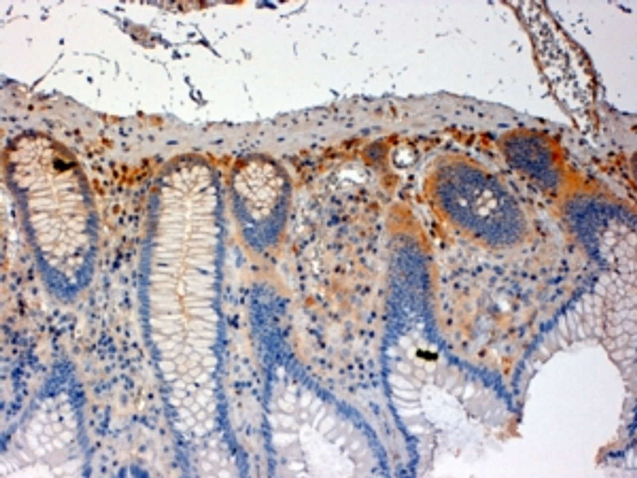 45-042 (4ug/ml) staining of paraffin embedded Human Colon. Steamed antigen retrieval with citrate buffer pH 6, HRP-staining.<strong>This data is from a previous batch, not on sale.</strong>