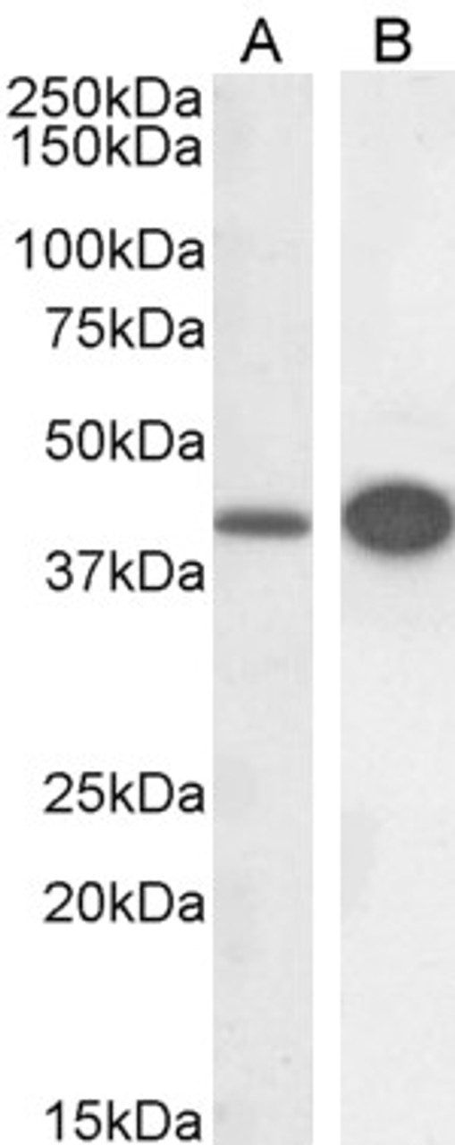 45-046 (0.3ug/ml) staining of HeLa (A) and HepG2 (B) cell lysate (RIPA buffer, 30ug total protein per lane) . Detected by chemiluminescence.