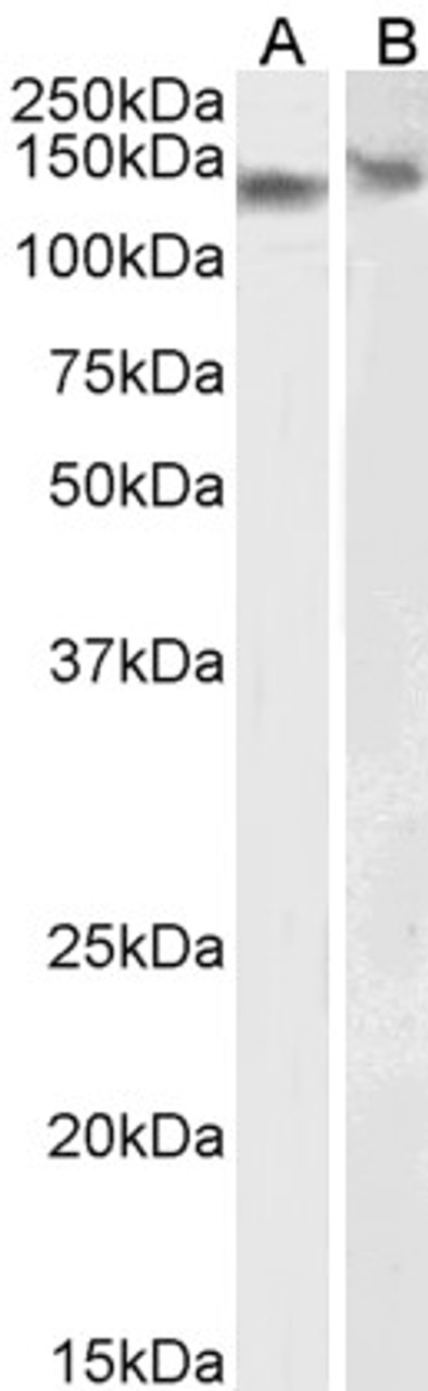 45-048 (0.01ug/ml) staining of NIH3T3 (A) and NSO (B) lysate. (35ug protein in RIPA buffer) . Detected by chemiluminescence.