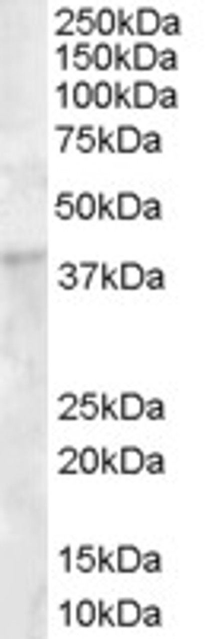 45-049 (1ug/ml) staining of Human Bone Marrow lysate (35ug protein in RIPA buffer) . Detected by chemiluminescence.