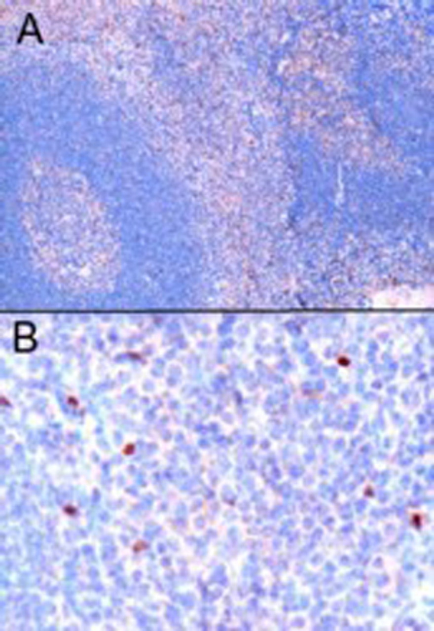 45-055 (1ug/ml) staining of paraffin embedded Human Tonsil. Microwaved antigen retrieval with Tris/EDTA buffer pH9, HRP-staining. A) Nuclear staining of scattered cells in the interfollicular area. B) High magnification of positive cells. <strong>This d