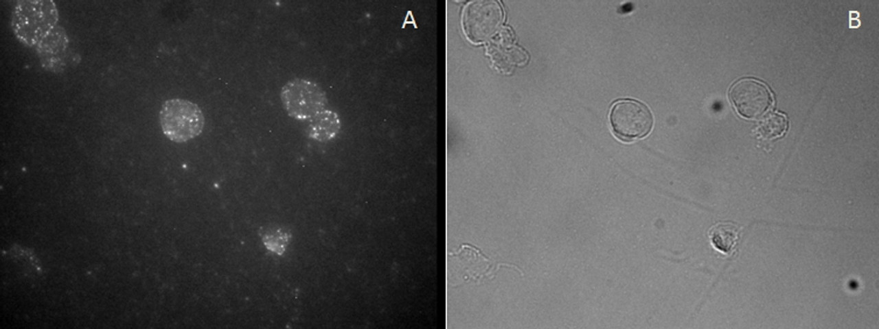 45-055 staining of CD25-sorted (Treg) Human blood cells gathered by cytospin and detected by FITC (A) and in phase contrast (B) .