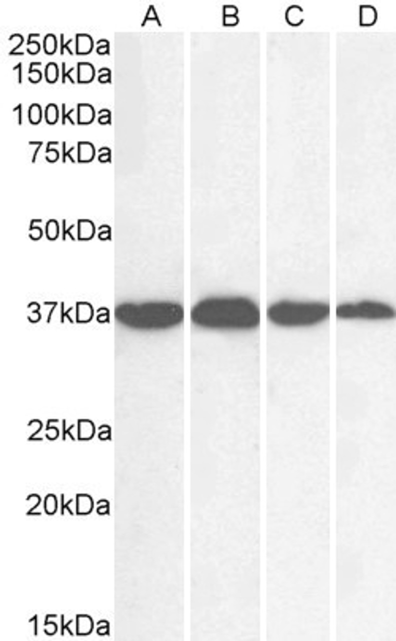 45-060 (0.01ug/ml) staining of cell lines HEK293 (A) and HeLa (B) and Human Liver (C) and Tonsil (D) lysate (35ug protein in RIPA buffer) . Detected by chemiluminescence.