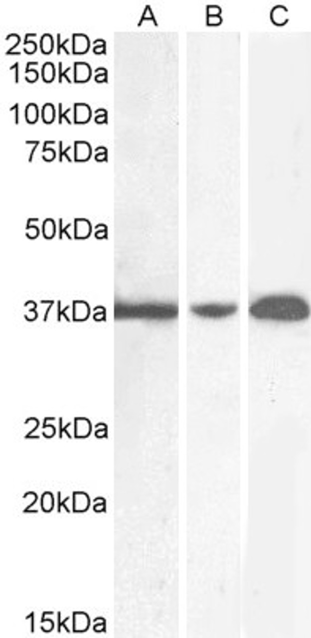 45-060 (0.01ug/ml) staining of Mouse Spleen (A) , (0.1ug/ml) Rat Brain (B) and (0.5ug/ml) Rat Spleen (C) (35ug protein in RIPA buffer) . Detected by chemiluminescence.
