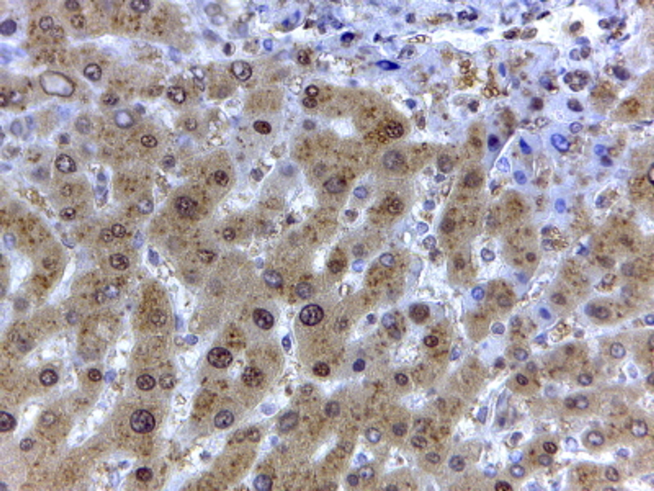 45-061 (0.1ug/ml) staining of Human Liver (A) , (0.03ug/ml) Testes (B) and Tonsil (C) lysate (35ug protein in RIPA buffer) . Detected by chemiluminescence.