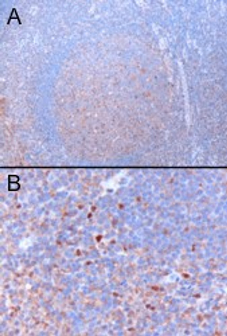 45-062 (3ug/ml) staining of paraffin embedded Human Tonsil. Microwaved antigen retrieval with citrate buffer pH 6, HRP-staining. A) staining of cells in the germinal centre, B) staining of cells in the interfollicular area. This data was obtained using