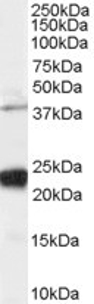 45-064 staining (0.03ug/ml) of Human HeLa cell lysate (RIPA buffer, 35ug total protein per lane) . Primary incubated for 1 hour. Detected by chemiluminescence.