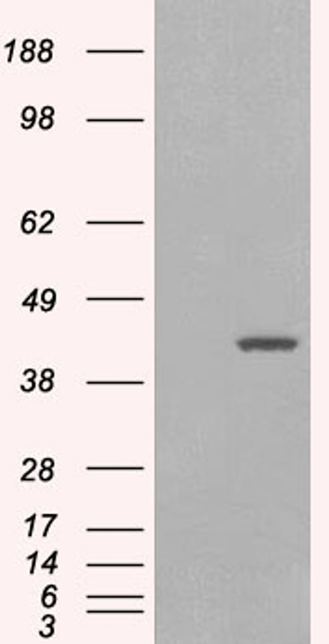 HEK293 overexpressing GIPC1 isoform 1 and probed with 45-064 (mock transfection in first lane) .