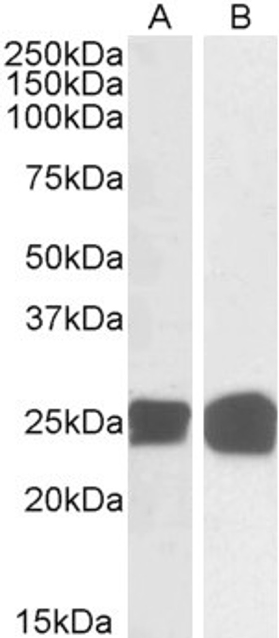 45-066 (0.05ug/ml) staining of Human Thymus (A) and MOLT4 (B) lysates (35ug total protein in RIPA buffer) . Primary incubated for 1 hour. Detected by chemiluminescence.