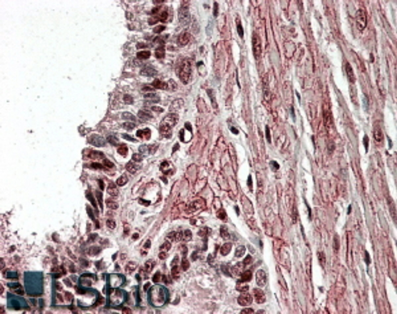 45-072 Immunofluorescence analysis of paraformaldehyde fixed HeLa cells, permeabilized with 0.15% Triton. Primary incubation 1hr (10ug/ml) followed by Alexa Fluor 488 secondary antibody (4ug/ml) , showing cytoplasmic staining. The nuclear stain is DAPI (b