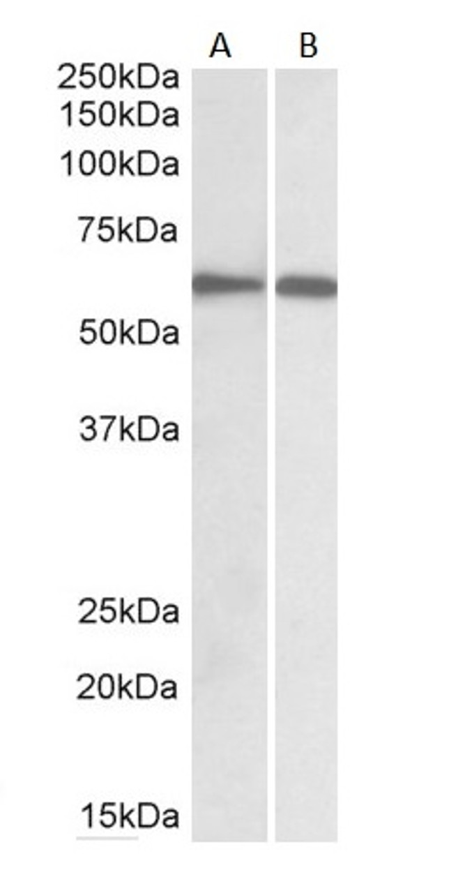 45-075 staining (1ug/ml) Human Spleen (A) and Peripheral Blood Lymphocytes (B) lysates (RIPA buffer, 30ug total protein per lane) . Detected by chemiluminescence