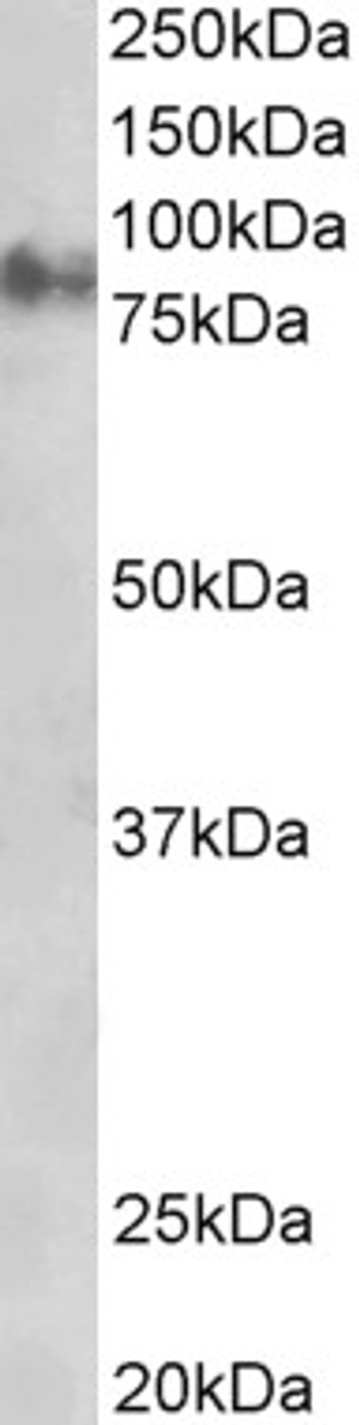 45-076 staining (1ug/ml) of Rat Eye lysate (RIPA buffer, 35ug total protein per lane) . Primary incubated for 1 hour. Detected by chemiluminescence.