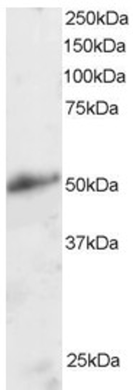 45-078 staining (2ug/ml) of Human Kidney lysate (RIPA buffer, 30ug total protein per lane) . Primary incubated for 1 hour. Detected by chemiluminescence.