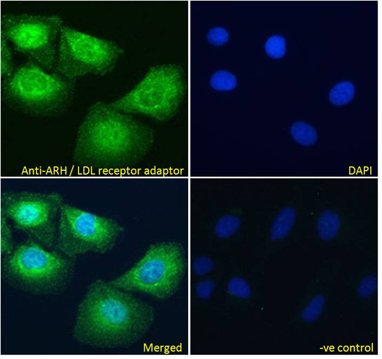 45-082 Immunofluorescence analysis of paraformaldehyde fixed U2OS cells, permeabilized with 0.15% Triton. Primary incubation 1hr (10ug/ml) followed by Alexa Fluor 488 secondary antibody (4ug/ml) , showing showing cytoplasmic and some nuclear staining. T