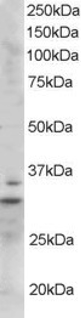 45-085 staining (1ug/ml) of Mouse Heart lysate (RIPA buffer, 35ug total protein per lane) . Primary incubated for 1 hour. Detected by western blot using chemiluminescence.