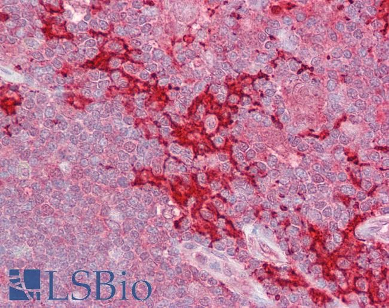 45-086 (2.5ug/ml) staining of paraffin embedded Human Thymus. Steamed antigen retrieval with citrate buffer pH 6, AP-staining.