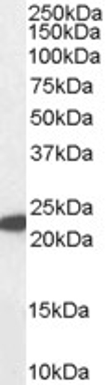 45-093 (1ug/ml) staining of Human Spleen lysate (35ug protein in RIPA buffer) . Primary incubation was 1 hour. Detected by chemiluminescence.