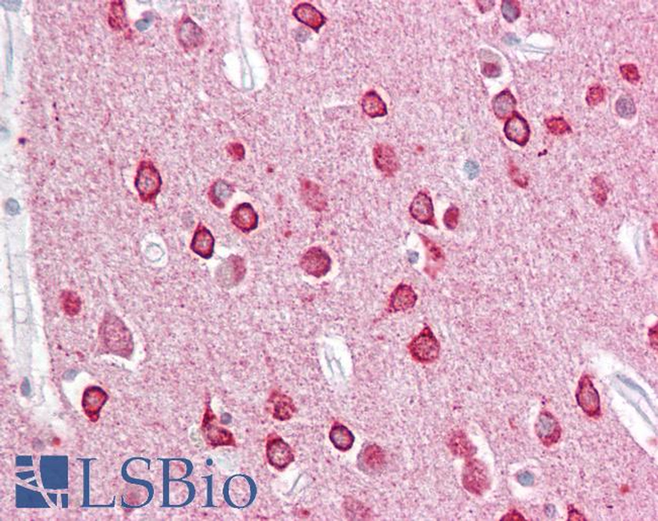 45-103 (2.5ug/ml) staining of paraffin embedded Human Cortex. Steamed antigen retrieval with citrate buffer pH 6, AP-staining.