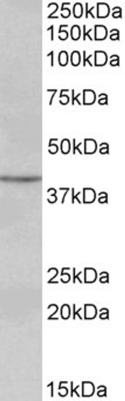 45-105 (0.3ug/ml) staining of Human Lymph lysate (35ug protein in RIPA buffer) . Primary incubation was 1 hour. Detected by chemiluminescence.