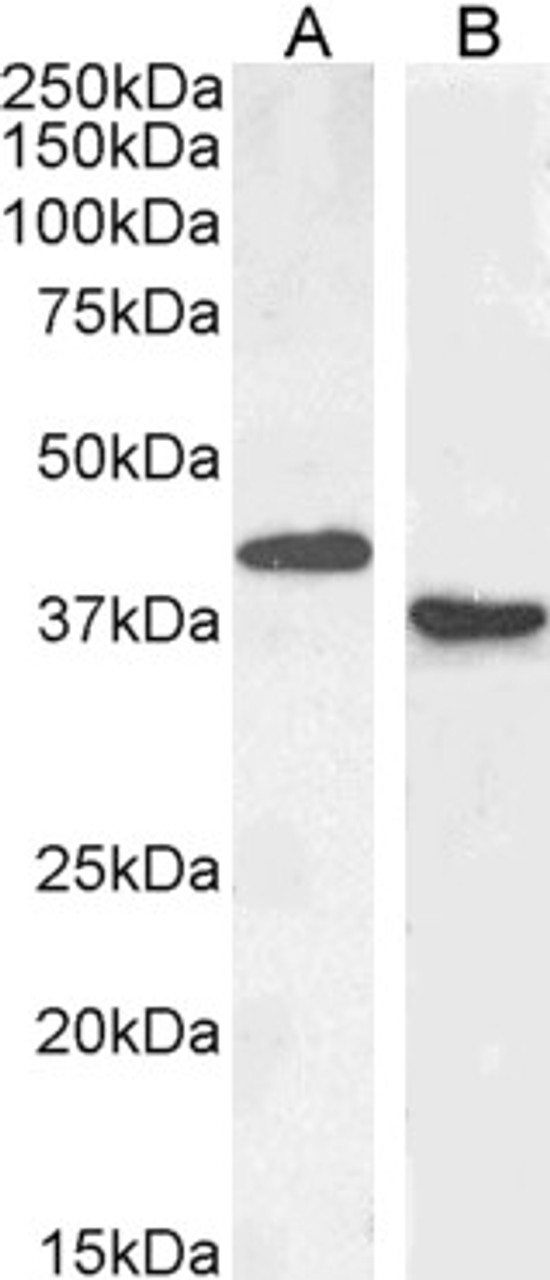 45-105 (1ug/ml) staining of Mouse (A) and (0.3ug/ml) Rat (B) Spleen lysate (35ug protein in RIPA buffer) . Primary incubation was 1 hour. Detected by chemiluminescen
