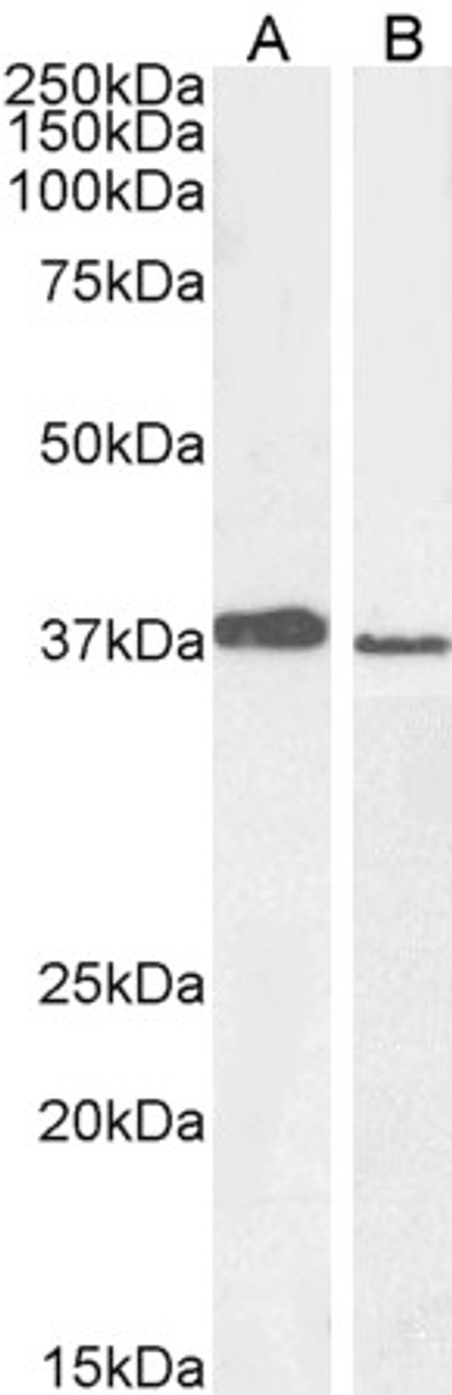 45-106 staining (1ug/ml) of A549 (A) and PD19 (B) cell lysate (RIPA buffer, 30ug total protein per lane) . Detected by chemiluminescence.