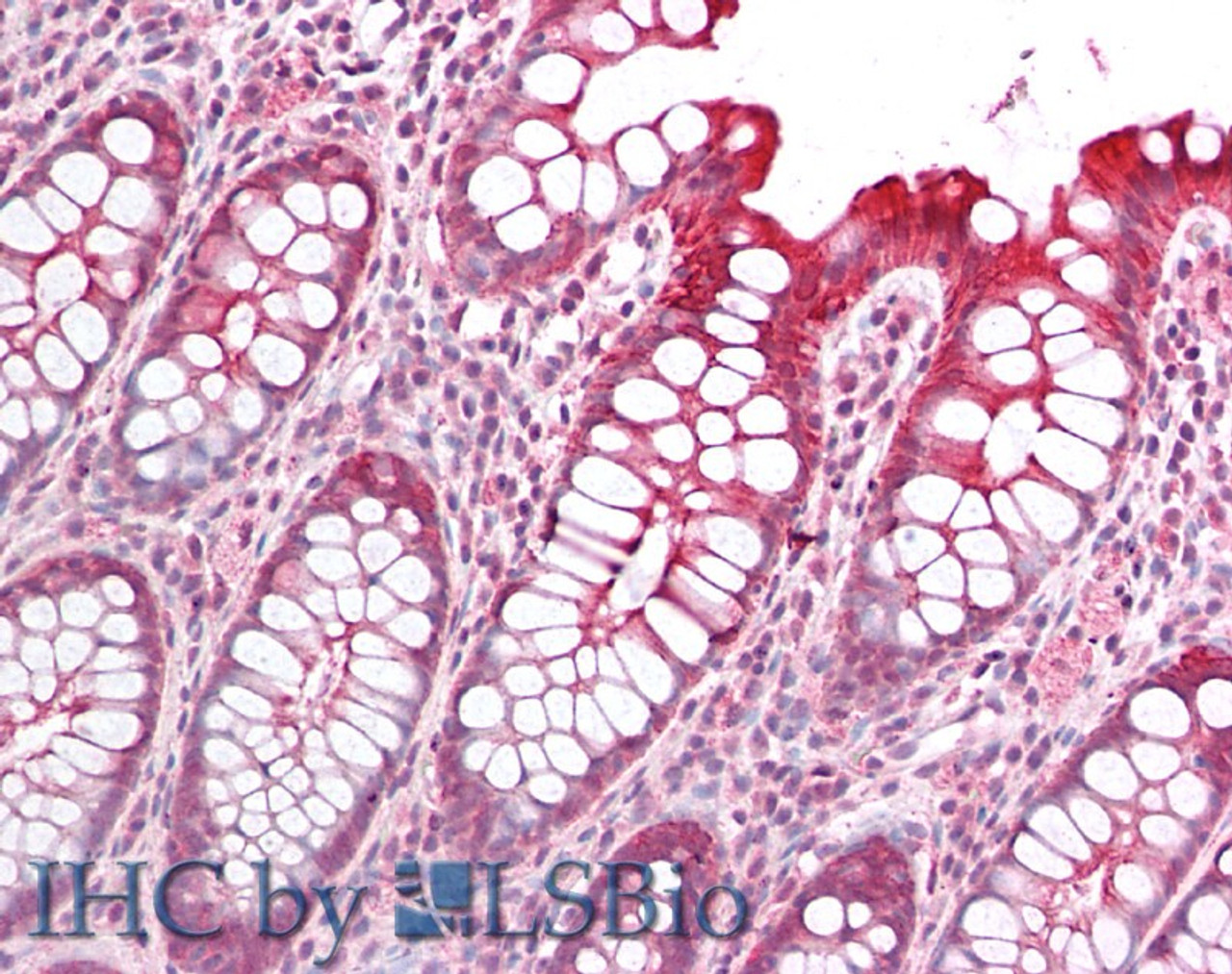 45-110 (1ug/ml) staining of Mouse Brain lysate (35ug protein in RIPA buffer) . Detected by chemiluminescence.