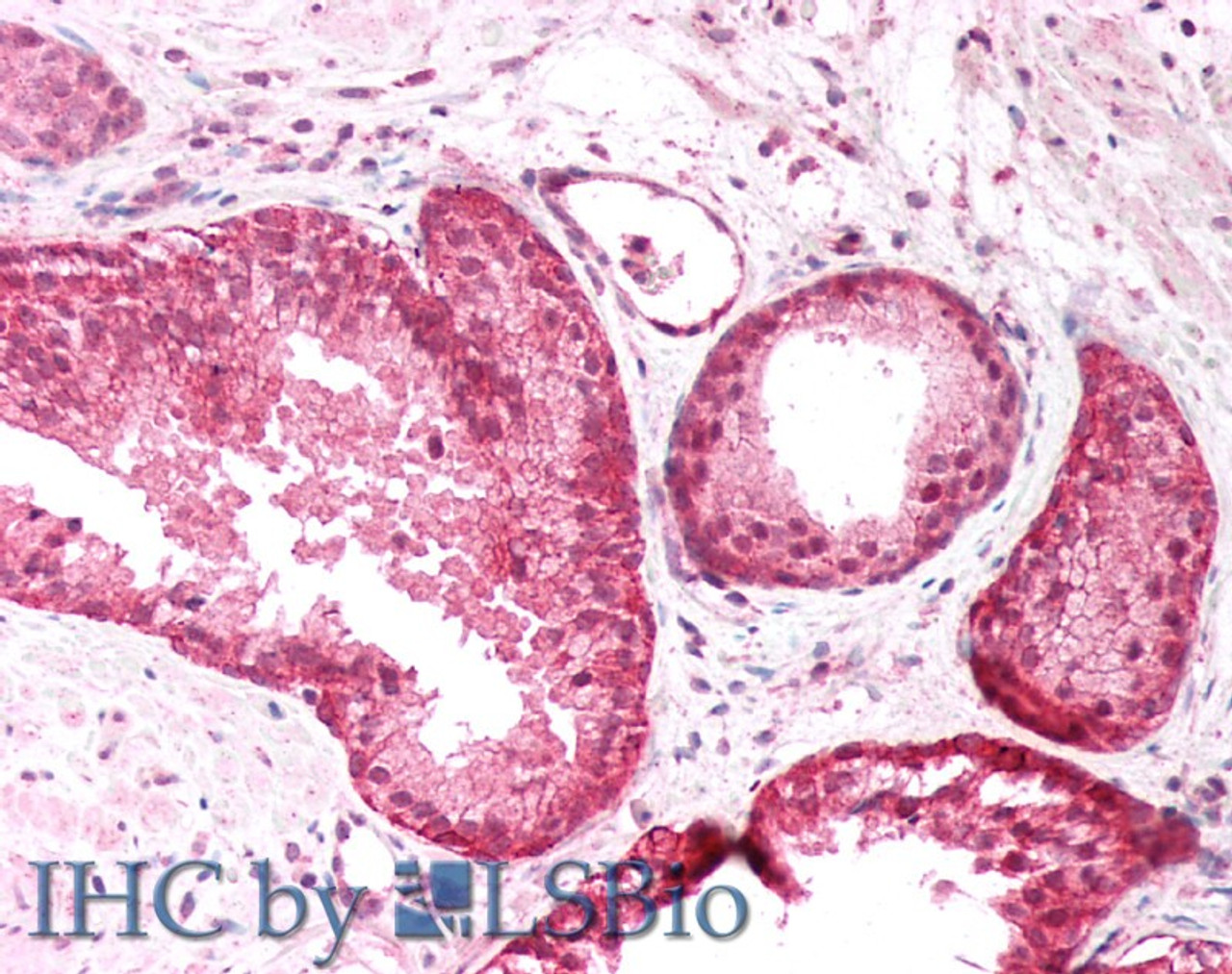 45-110 (5ug/ml) staining of paraffin embedded Human Colon. Steamed antigen retrieval with citrate buffer pH 6, AP-staining.