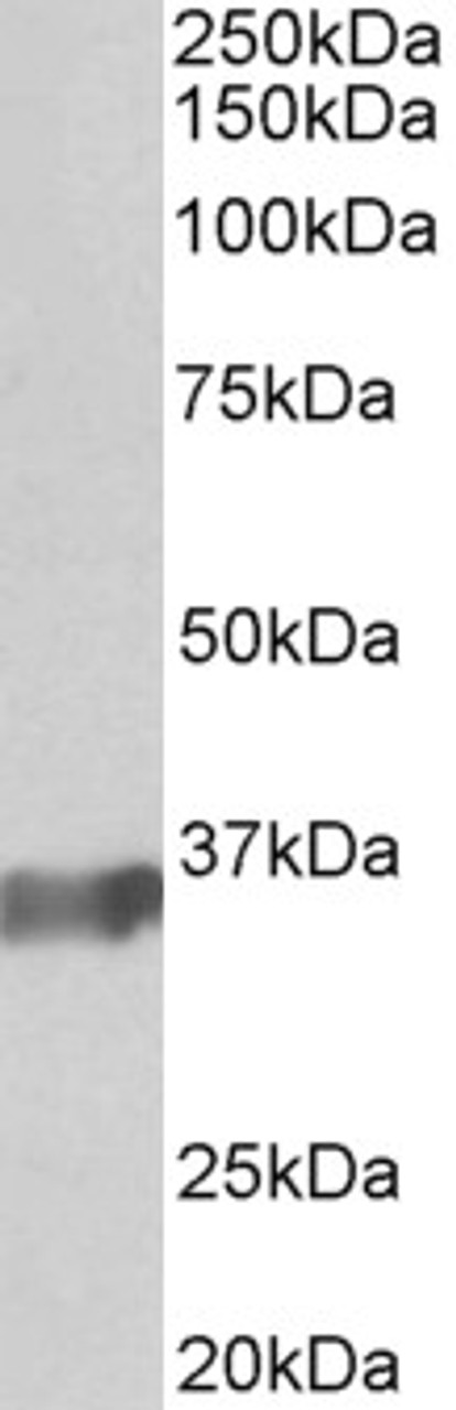 45-116 (0.3ug/ml) staining of Human (A) , Mouse (B) and Rat (C) Spleen lysate (35ug protein in RIPA buffer) . Primary incubation was 1 hour. Detected by chemiluminescence.