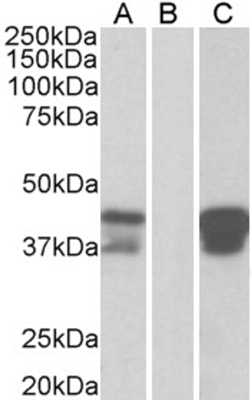 HEK293 lysate (10ug protein in RIPA buffer) overexpressing Human BOB1 with DYKDDDDK tag probed with 45-116 (1ug/ml) in Lane A and probed with anti- DYKDDDDK Tag (1/3000) in lane C. Mock-transfected HEK293 probed with 45-116 (1mg/ml) in Lane B. Primary inc