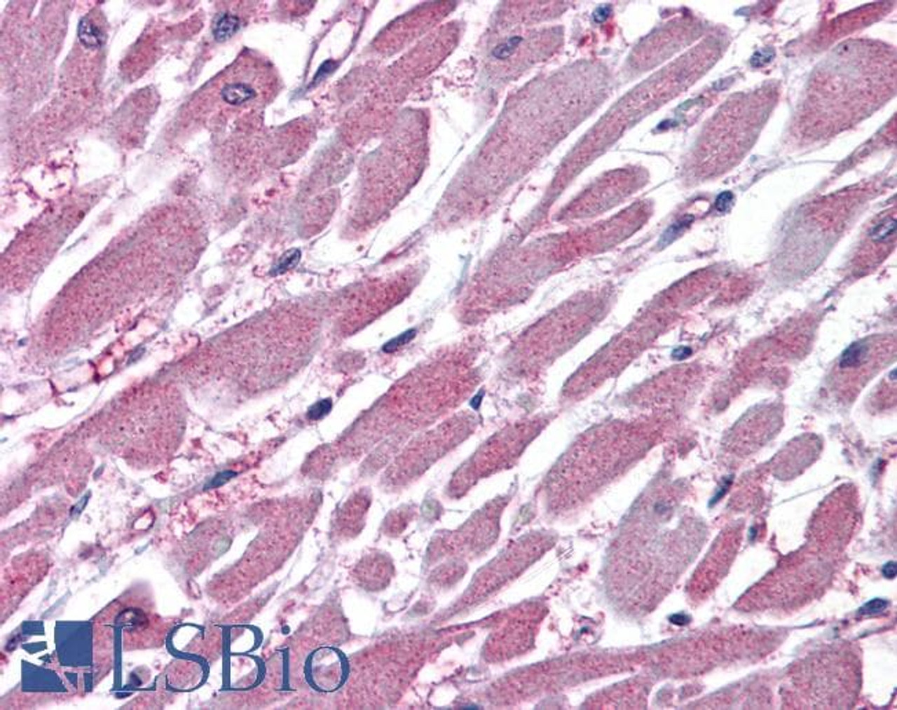 45-120 (3.75ug/ml) staining of paraffin embedded Human Thyroid Gland. Steamed antigen retrieval with citrate buffer pH 6, AP-staining. <strong>This data is from a previous batch, not on sale.</strong>