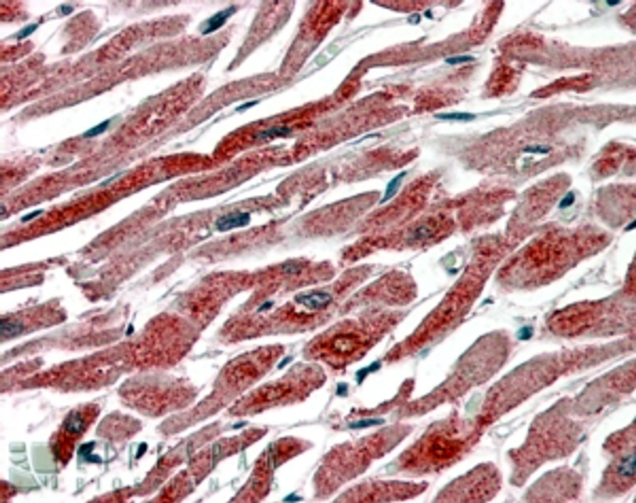 45-124 (3.8ug/ml) staining of paraffin embedded Human Heart. Steamed antigen retrieval with citrate buffer pH 6, AP-staining. <strong>This data is from a previous batch, not on sale.</strong>