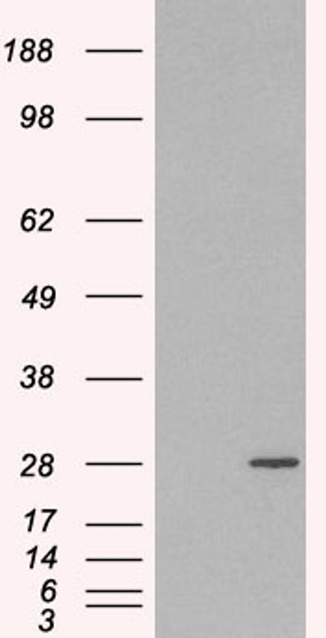 HEK293 overexpressing RAB11A and probed with 45-130 (mock transfection in first lane) .