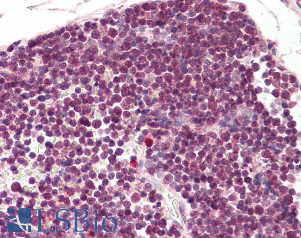 45-133 (3.75ug/ml) staining of paraffin embedded Human Thymus. Steamed antigen retrieval with citrate buffer pH 6, AP-staining. This data was obtained using a previous batch.