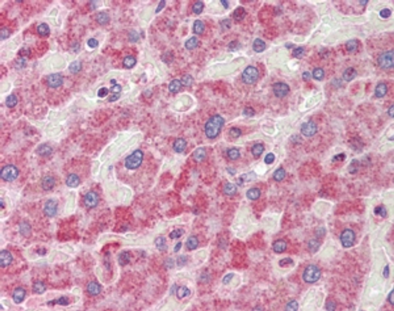 45-135 (2.5ug/ml) staining of paraffin embedded Human Liver. Steamed antigen retrieval with citrate buffer pH 6, AP-staining.