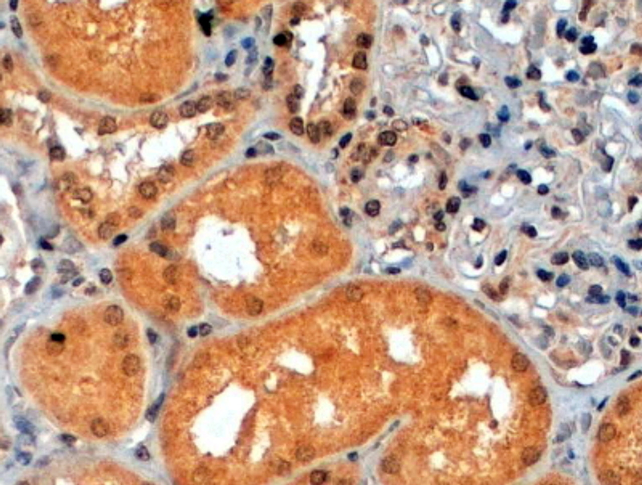 45-138 (2ug/ml) staining of paraffin embedded Human Kidney. Steamed antigen retrieval with citrate buffer pH 6, HRP-staining.