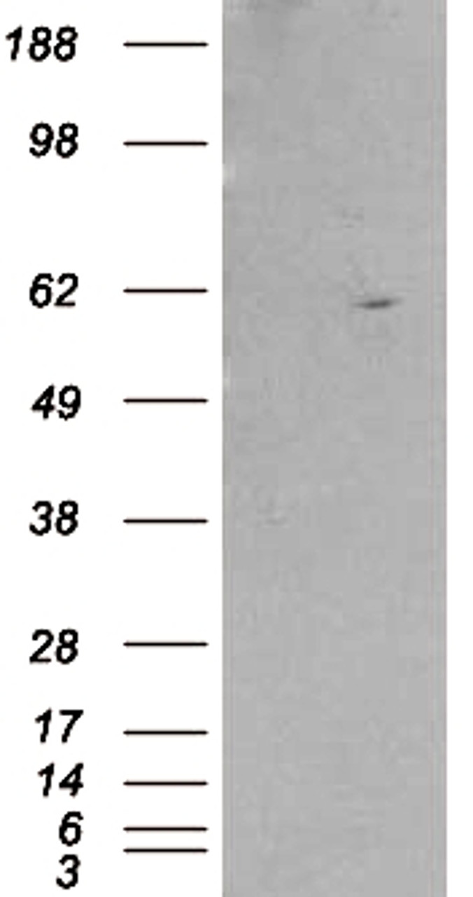 HEK293 overexpressing RXRB and probed with 45-140 (mock transfection in first lane) .