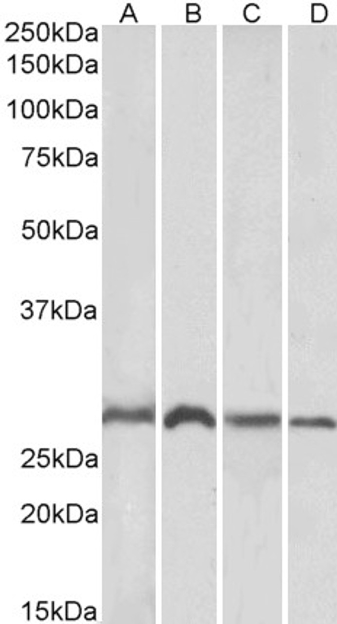 45-144 (1ug/ml) staining of Mouse (A, C) and Rat (B, D) Brain (A, B) and Liver (C, D) lysates (35ug protein in RIPA buffer) . Detected by chemiluminescence.