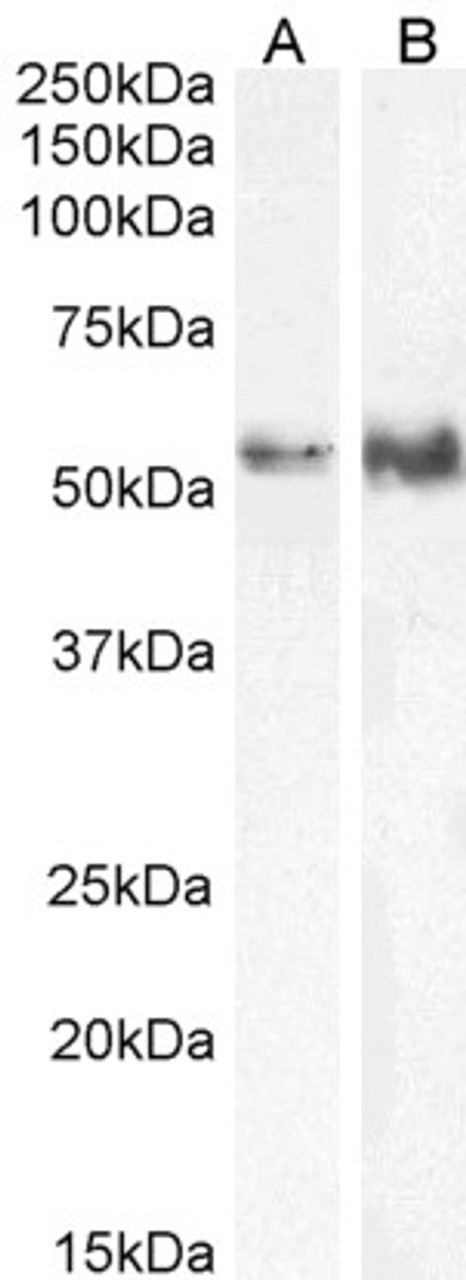 45-159 (0.5ug/ml) staining of HeLa (A) and (0.3ug/ml) Jurkat (B) cell lysate (35ug protein in RIPA buffer) . Detected by chemiluminescence.