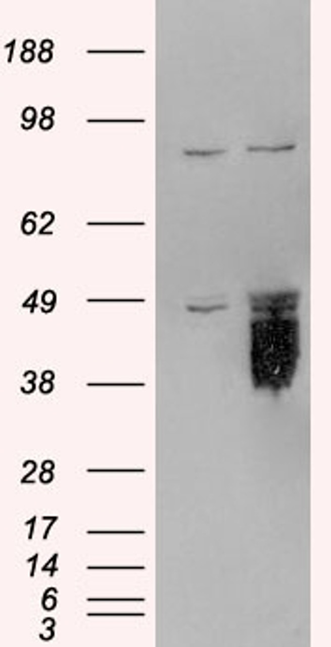 HEK293 overexpressing TFPI and probed with 45-160 (mock transfection in first lane) .
