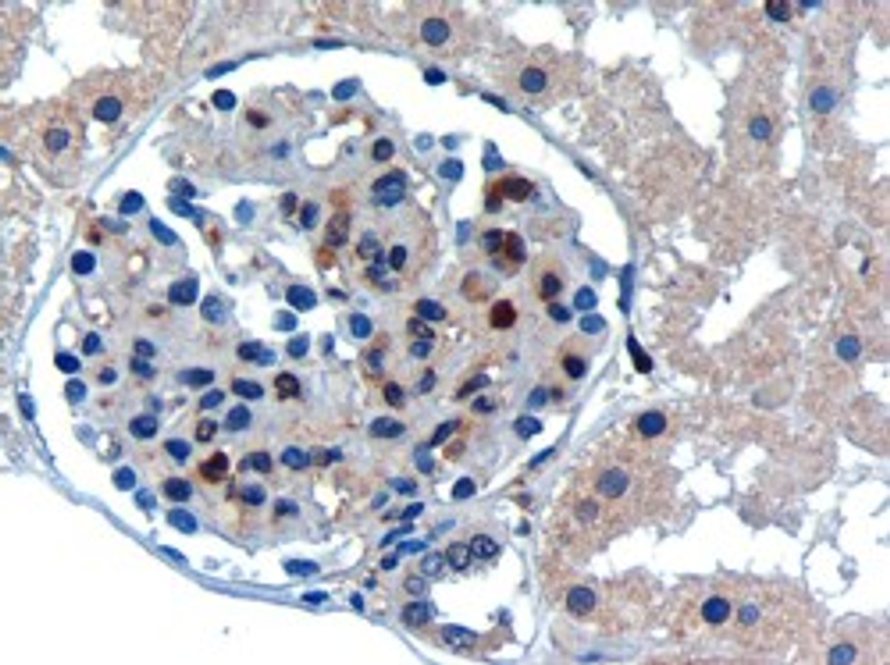 45-164 (0.3ug/ml) staining of paraffin embedded Human Kidney. Microwaved antigen retrieval with Tris/EDTA buffer pH9, HRP-staining.