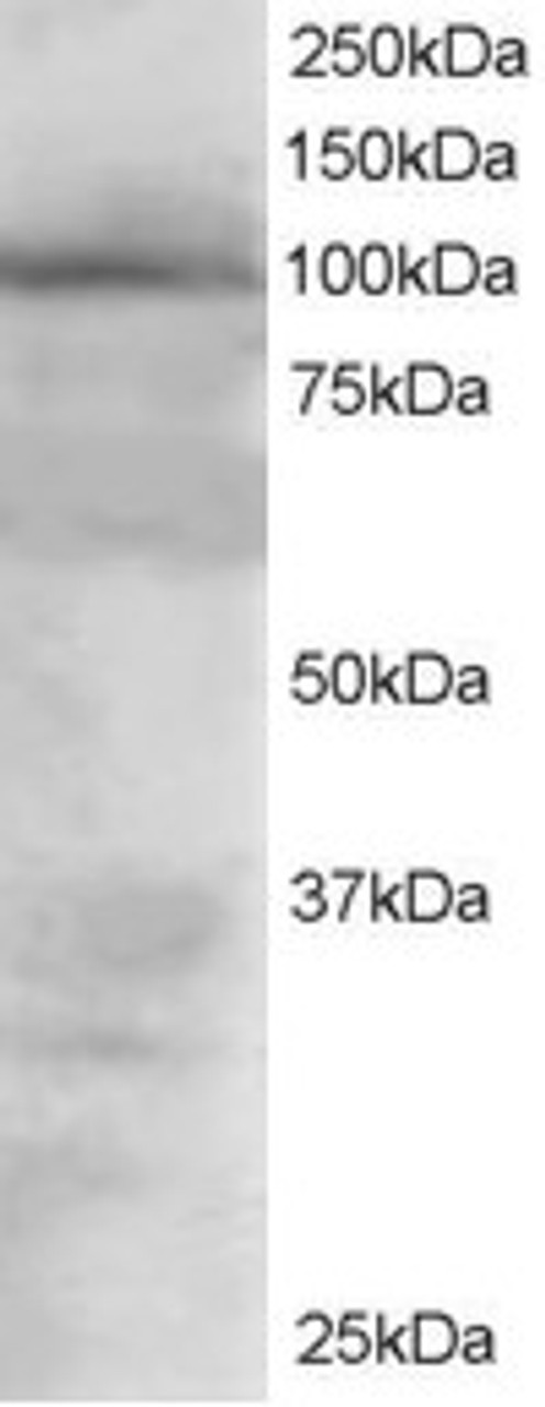 45-168 staining (1.5ug/ml) of 293 lysate (RIPA buffer, 30ug total protein per lane) . Primary incubated for 1 hour. Detected by western blot using chemiluminescence.
