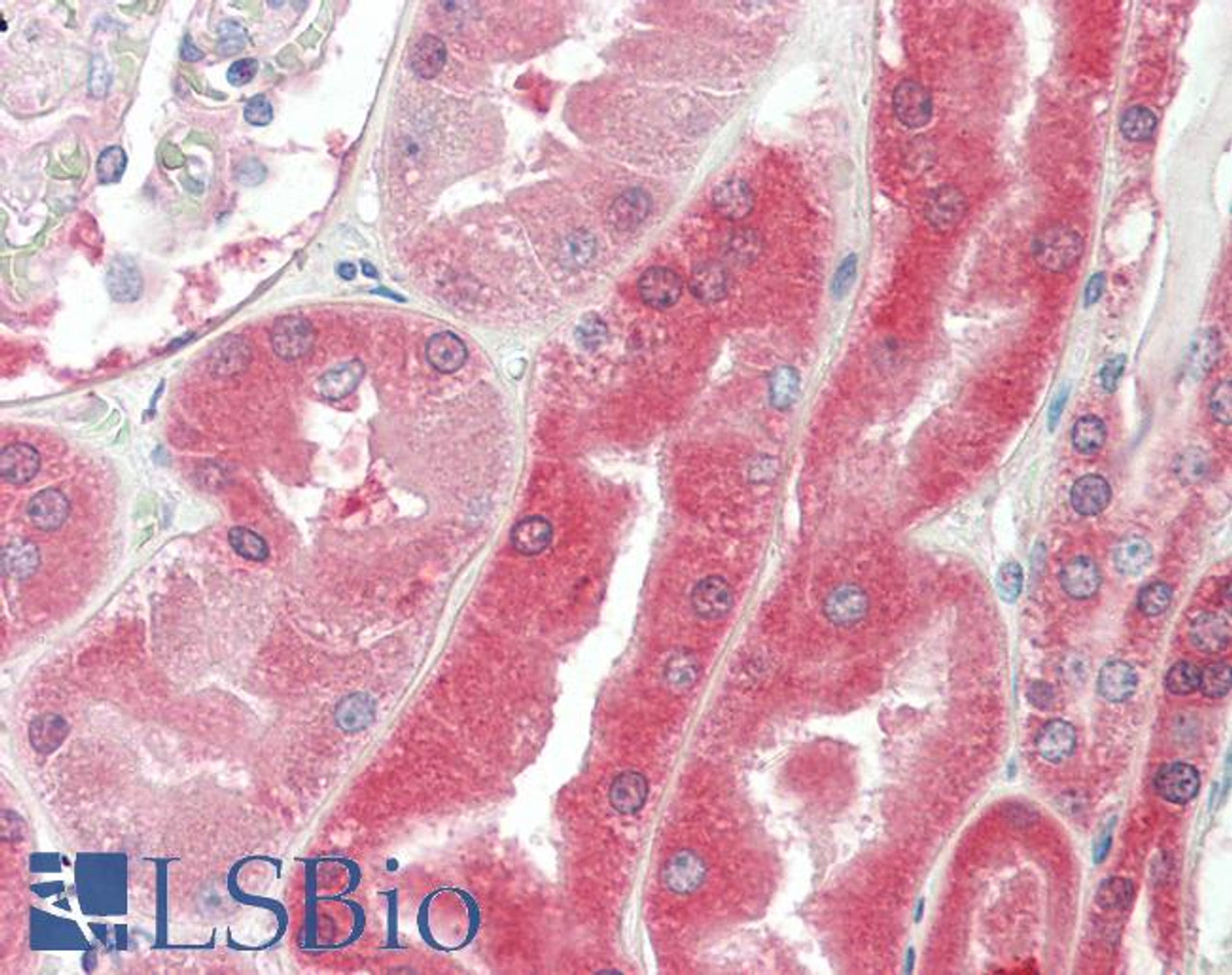 45-170 (1.5ug/ml) as the reporter antibody.